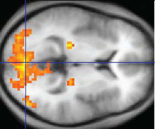 fMRI